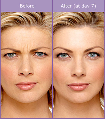 Liverpool Botox Aesthetics Clinic