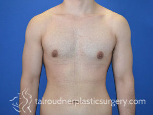 Male Plastic Surgery