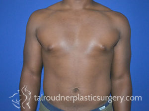 Male Plastic Surgery