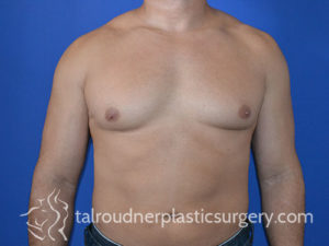Male Plastic Surgery